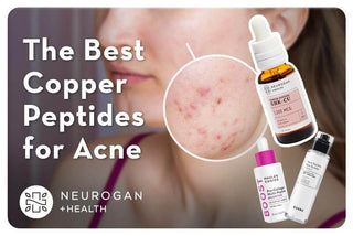 Acne prone skin and popular peptide products. Text: The best copper peptides for acne.