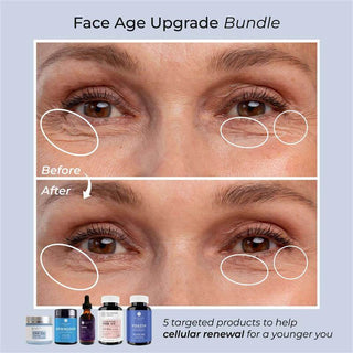 Face Age Upgrade Kit before and after results, showing reduced wrinkles around the eyes with five targeted supplements.