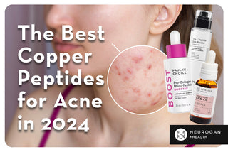 Acne prone skin and popular peptide products. Text: The best copper peptides for acne in 2024