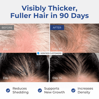 GHK-Cu Copper Peptide Hair & Scalp Serum before and after results showing thicker, fuller hair in 90 days.