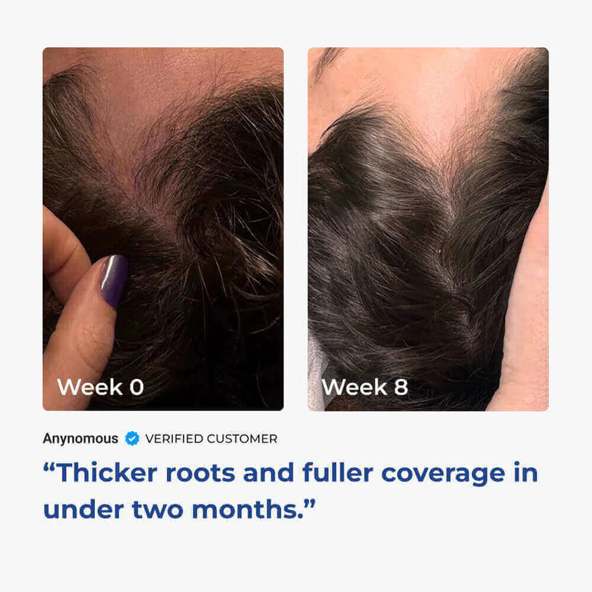 AHK Cu GHK Cu Hair Serum Pro 4800mg Hair Growth Neurogan Health