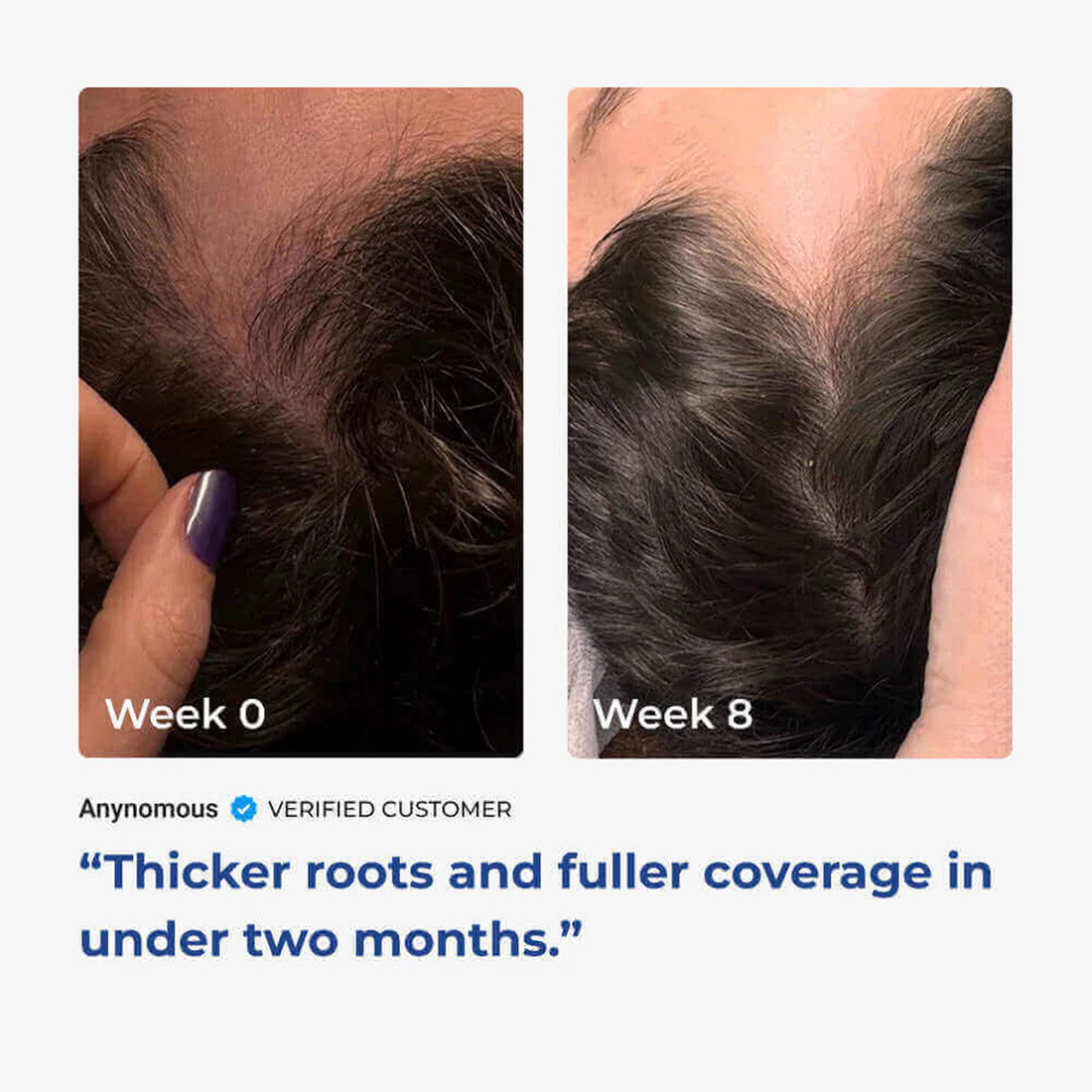 AHK Cu GHK Cu Hair Serum Pro 4800mg Hair Growth Neurogan Health AHK Cu GHK Cu Hair Serum Pro 4800mg Hair Growth Neurogan Health