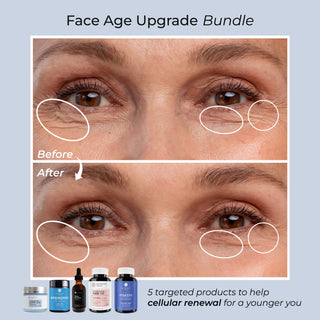  Face Age Upgrade Kit before and after results, showing reduced wrinkles around the eyes with five targeted supplements.