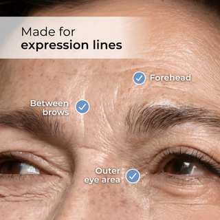Where to use Syn-Ake Peptide Face Cream: forehead lines, between the brows and the outer eye area.