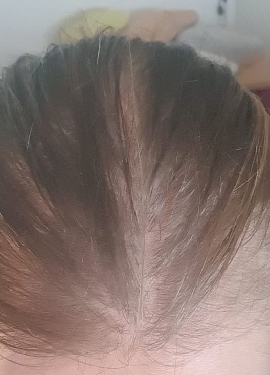 K.W., Week 0
