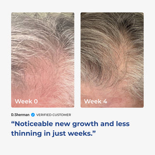 Before and after photos of hair improvement showing smoother and more manageable hair after 4 weeks of product use.