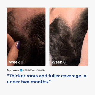 Side-by-side comparison of hair growth progress from week 0 to week 2, showing visible change and improvement.