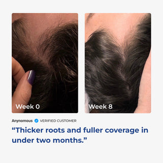 Side-by-side comparison of hair growth progress from week 0 to week 2, showing visible change and improvement.