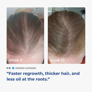 Before and after images of hair regrowth, showing Week 0 and Week 12 results, highlighting thicker hair and less oil.